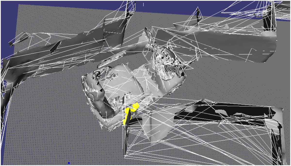 Collision detection